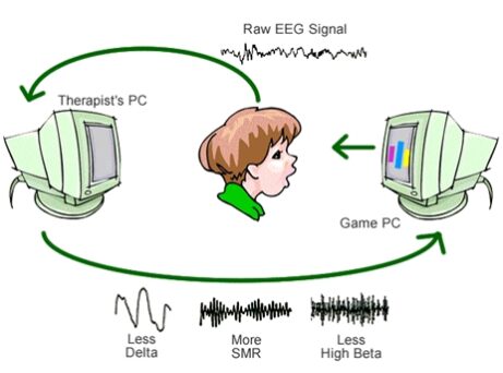 Neurofeedback - trénink mozkových vln pomocí EEG biofeedbacku